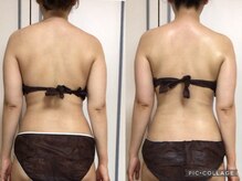 サロン ジョリー(Salon Jolie)/肩こりや丸い背中にインディバ！