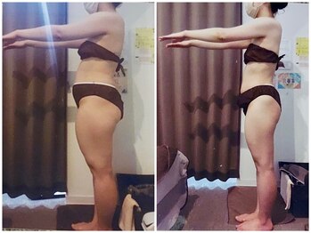 クイーン 札幌駅前店(Queen)/お客様 ビフォーアフター(13)