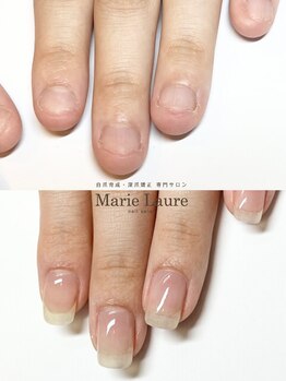 マリーロール 梅田店(Marie Laure)/自爪育成/深爪矯正/ネイルケア