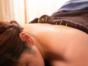 リラクゼーション恵み/はり灸が初めての方も◎