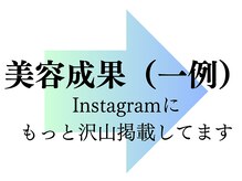 レイ(R.E.I)/美容施術の成果はここから♪