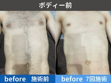 アテ 古波蔵店(ATE)の雰囲気（結果重視☆日に日に実感してサロンに通うのが楽しみになる♪）