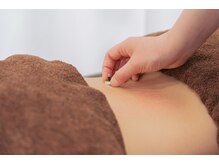 キュアスタ整体院 神楽坂駅前(CureSta)/灸施術風景