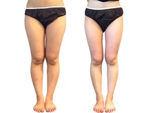 ヨサパーク リワード 本八幡駅前店(YOSA PARK Reward)/