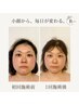 スッキリ小顔矯正＋至福のヘッドスパ60分