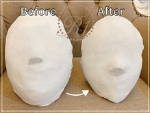 R-1ビューティーサロン 銀座/BEFORE＆AFTER　