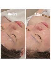 イチグラム(Ichi Glam)/ララピール効果