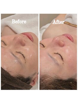 イチグラム(Ichi Glam)/ララピール効果