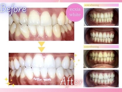 エクシアホワイトニング 仙台駅東口店の写真