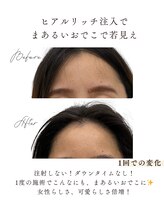 エフリア 大垣(F.lia)/まんまるおでこが叶う！