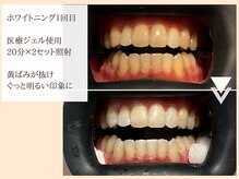 レイテノール 藤沢店の雰囲気（クリニック提携ホワイトニング始めました！1回でこの変化）