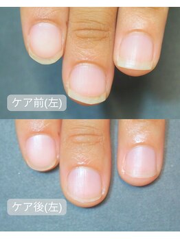 キラリネイル(KIRARINAIL)/お客さまの変化
