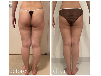 美人バスト 新宿店/☆姉妹店ダイエット症例写真☆