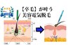 超人気★『唯一無二の永久的脱毛しませんか』美容電気脱毛【10分クーポン】