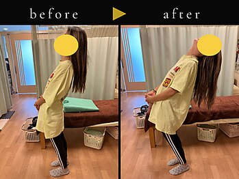 杉本接骨鍼灸院/背骨から全身がユルユル整体
