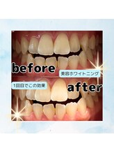 ソレイユ(Soleil)/ビフォーアフター８