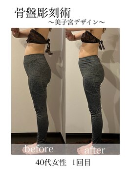 マージェ(magie)/新技術☆骨盤美子宮デザイン