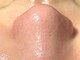 ミラーヴ(MERAVE)の写真/【メンズも通いやすい毛穴洗浄サロン★】男性特有の頑固な毛穴汚れに徹底アプローチ！ニキビケアにも◎