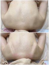 エヌエー(na)/背中から変わるバストアップケア