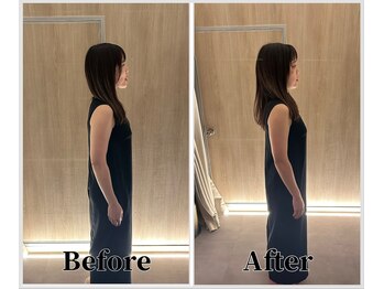 整体ラルース 中目黒(LALUZ)/20代 女性 猫背、巻き肩改善