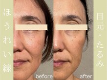 健志接骨院/πテラピー造顔メソッド