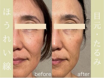 健志接骨院/πテラピー造顔メソッド