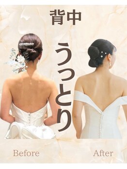 リアン整体院/【二の腕】印象に激変★