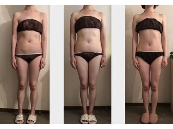 エステアンドネイルサロン ぶらんぶりえ/全身筋膜セル（90）