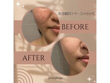 ハリーベージュ(Hariy Beige)/HariyBeige麻布十番