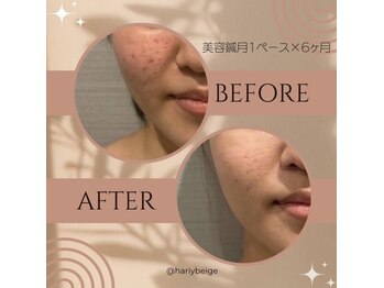 ハリーベージュ(Hariy Beige)/HariyBeige麻布十番