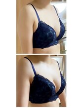 カナエルサロン 旭川(KANAERU SALON)/【バストアップ】症例☆