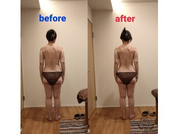 ブランシュール(blancheur)の写真/スマホ首や猫背、巻き肩…姿勢が歪むと老けて見える…骨格から整えて、美シルエット＆快適な身体へ◎