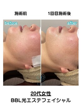 サロンアメリ 御座店(Salon Ameri)/高知　全身脱毛　サロンアメリ