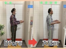 かぎとり接骨院の雰囲気(50代男性24回の施術で姿勢改善!痛みの出にくいお身体に!)
