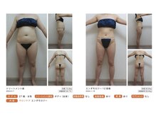 ピカイチ 上通店(pikAicHi)/サーモシェイプ/エンダモロジー