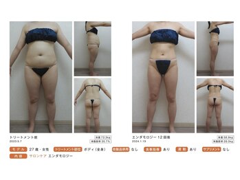 ピカイチ 上通店(pikAicHi)/サーモシェイプ/エンダモロジー