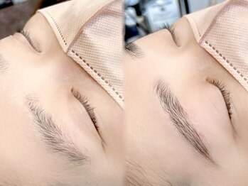 アド アール(add R)/HBL(ハリウッドブロウリフト)