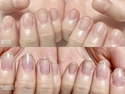 ディーア(Diae.)の写真