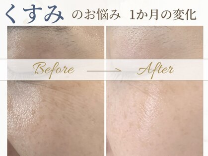 サロン ド コスメ ベル フルール(Salon de Cosme Belle Fleur)の写真