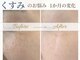 サロン ド コスメ ベル フルール(Salon de Cosme Belle Fleur)の写真