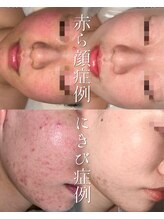 韓国肌管理室 ソア(soa)