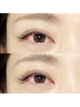 チョコ(CHOCO)/ボリュームラッシュ100束コース