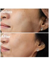 ペルル(Perle)/クリスティーナ ビオフィート