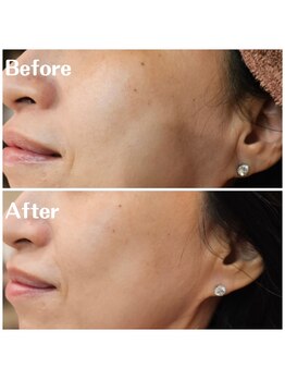 ペルル(Perle)/クリスティーナ ビオフィート