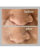 ダリア(DAHLIA)/ハイドラスプラッシュ