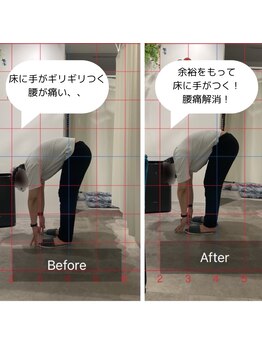 ナオル整体 銀座院(NAORU整体)/腰痛改善before after