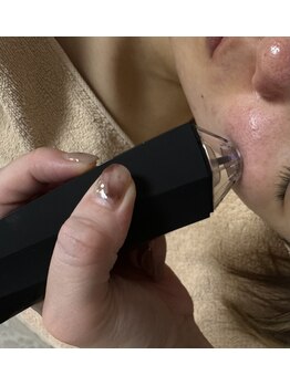 エミニティ トータルビューティーサロン(Eminity)/プラズマフェイシャル