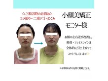 小顔矯正専門店 シンメトリー 千葉中央店の雰囲気（歪みの根本から整えますので、変化がわかりやすいです♪）