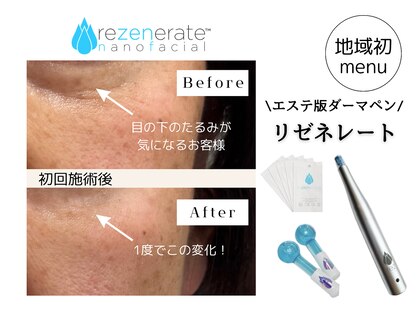 ラウレア(laule'a)の写真