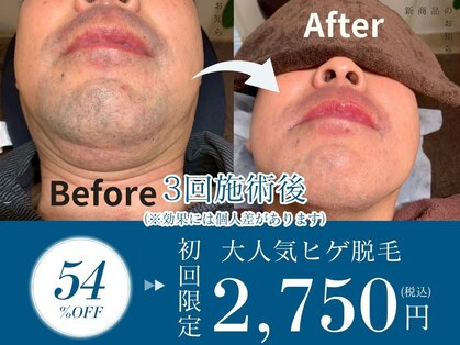 チャンス(CHANCE)の写真